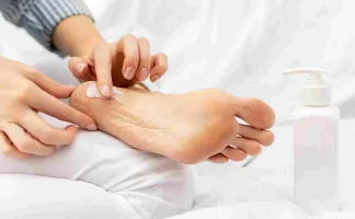 5 Obat Terbaik untuk Menghilangkan Kaki Pecah-Pecah